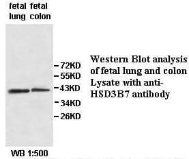 Anti-HSD3B7