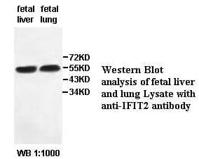 Anti-IFIT2