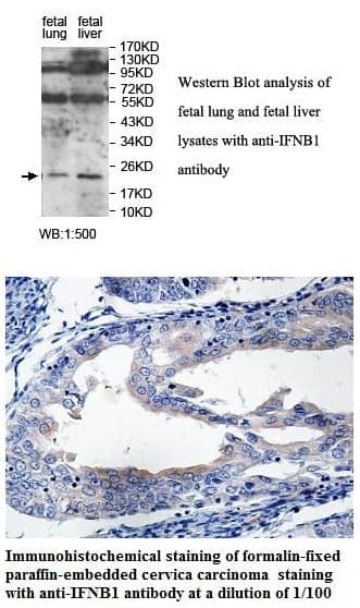Anti-IFNB1