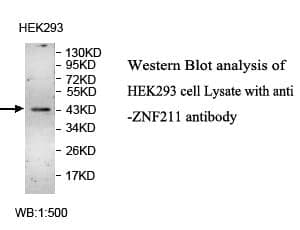 Anti-IL1R2