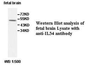 Anti-IL34