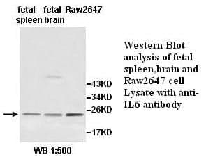 Anti-IL6