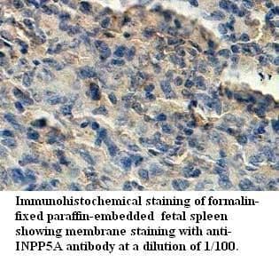 Anti-INPP5A