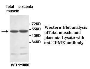 Anti-IPMK