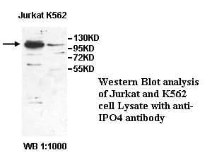 Anti-IPO4