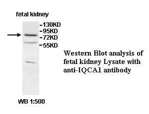 Anti-IQCA1