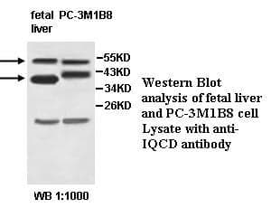 Anti-IQCD