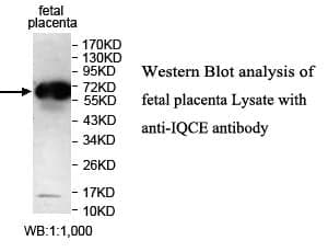 Anti-IQCE
