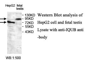 Anti-IQUB