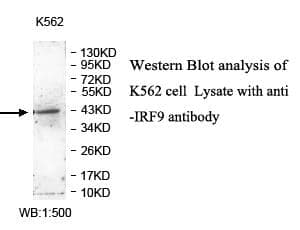 Anti-IRF9