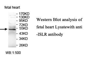 Anti-ISLR