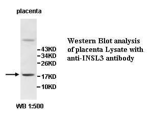 Anti-INSL3