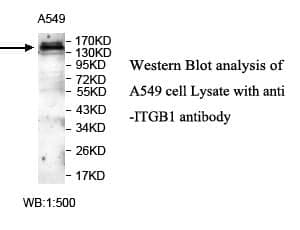 Anti-ITGB1