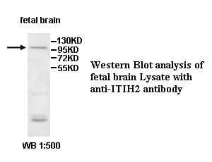 Anti-ITIH2