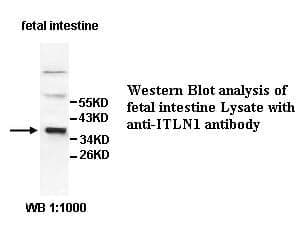 Anti-ITLN1