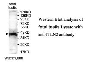 Anti-ITLN2