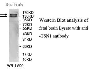 Anti-ATSN1