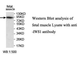 Anti-IWS1