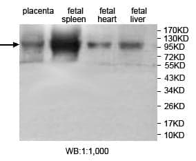Anti-JHDM1D