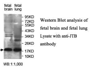 Anti-JTB