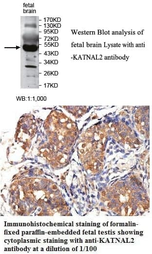 Anti-KATNAL2