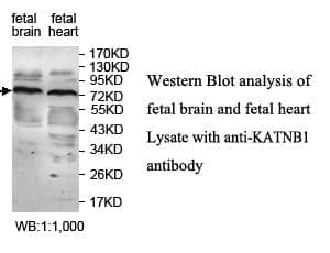 Anti-KATNB1