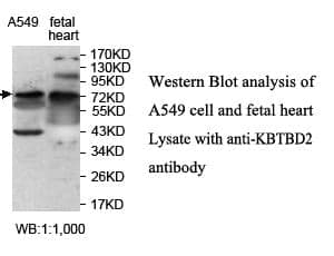 Anti-KBTBD2