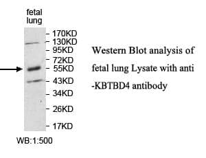 Anti-KBTBD4