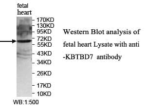 Anti-KBTBD7
