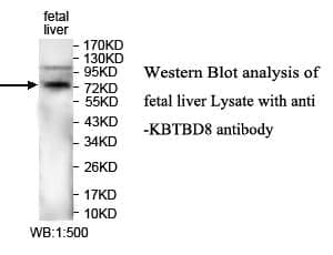 Anti-KBTBD8