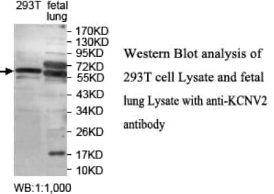 Anti-KCNV2