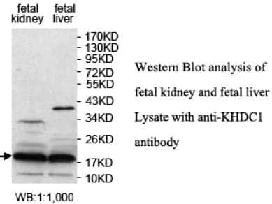 Anti-KHDC1
