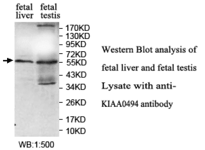 Anti-KIAA0494