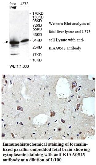 Anti-KIAA0513