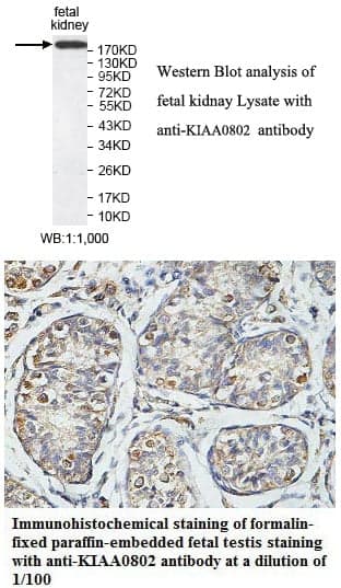 Anti-KIAA0802