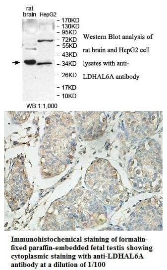 Anti-LDHAL6A