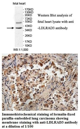 Anti-LDLRAD3