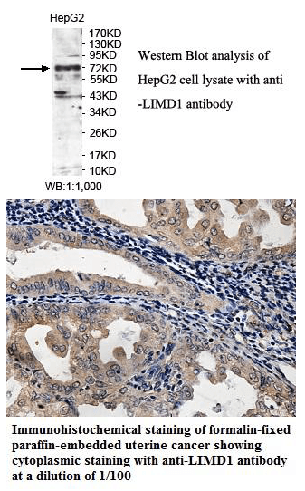 Anti-LIMD1