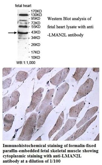 Anti-LMAN2L