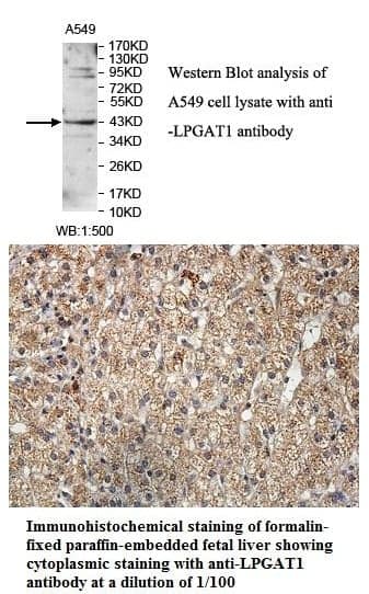 Anti-LPGAT1