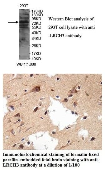 Anti-LRCH3