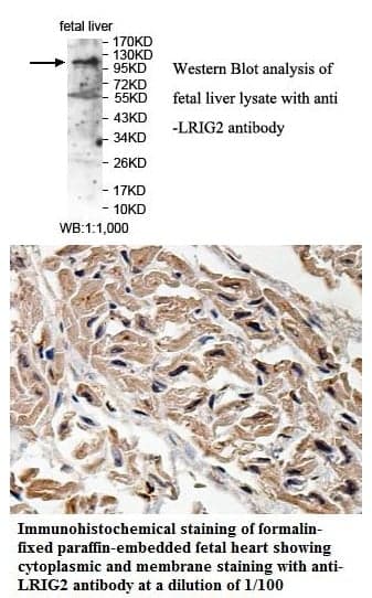 Anti-LRIG2