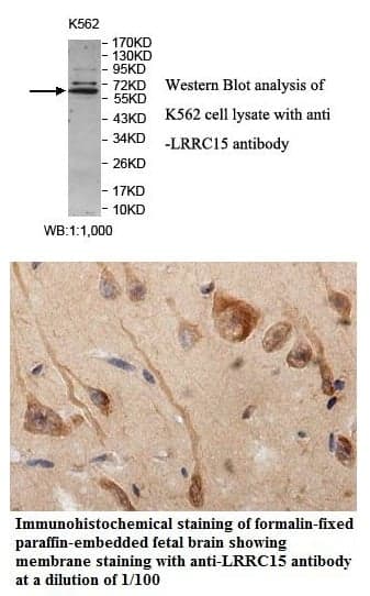 Anti-LRRC15