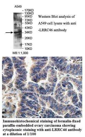 Anti-LRRC46