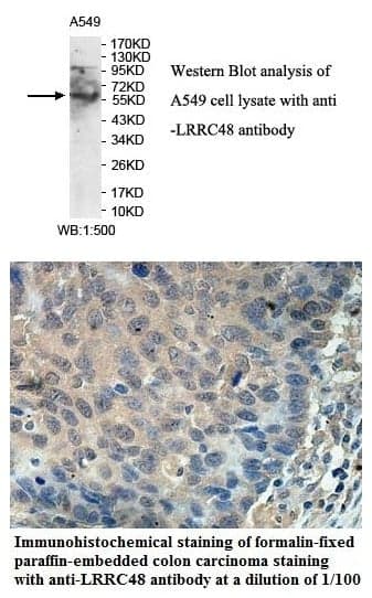 Anti-LRRC48