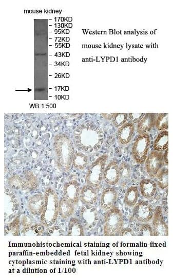 Anti-LYPD1