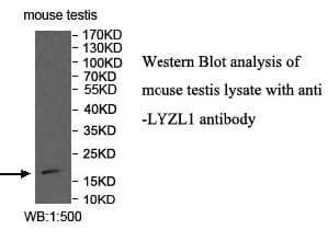 Anti-LYZL1