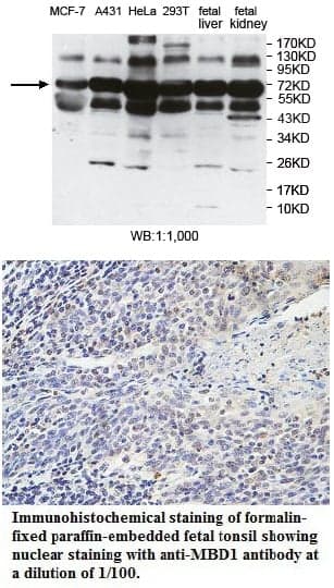 Anti-MBD1