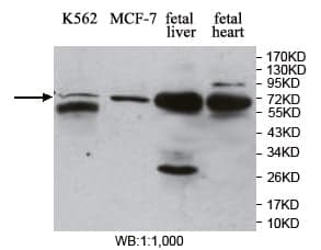 Anti-MBD4
