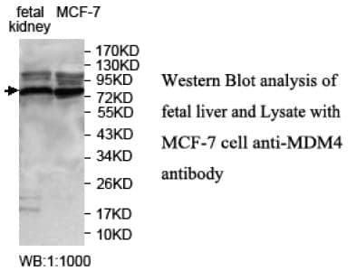 Anti-MDM4 Antibofy